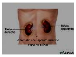 Anomalias del aparato urinario superior  riñon 