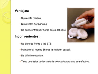 Ventajas:

   • Sin receta medica.

   • Sin efectos hormonales

   • Se puede introducir horas antes del coito.

Inconvenientes:

   • No protege frente a las ETS

   • Mantener al menos 6h tras la relación sexual.

   • De difícil colocación.

   • Tiene que estar perfectamente colocado para que sea efectivo.
 