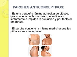 PARCHES ANTICONCEPTIVOS:
  Es una pequeña lámina adhesiva de plástico
que contiene las hormonas que se liberan
lentamente e impiden la ovulación y por tanto el
embarazo.

 El parche contiene la misma medicina que las
píldoras anticonceptivas.
 