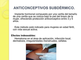 ANTICONCEPTIVOS SUBDÉRMICO.
  Implante hormonal compuesto por una varilla del tamaño
 de una cerilla que se coloca bajo la piel del brazo de la
 mujer, ofreciendo protección anticonceptivo entre 3 y 5
 años.

  Este método está indicado para mujeres en edad fértil,
 con vida sexual activa.

Efectos indeseables:
   Hematoma en el área de aplicación, infección local,
 dermatosis, irregularidades menstruales, cefalea.
 