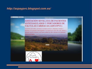 http://aspaypvc.blogspot.com.es/
 