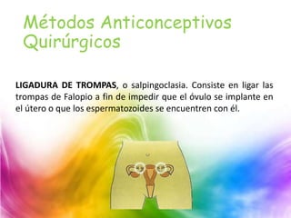 Métodos Anticonceptivos
Quirúrgicos
LIGADURA DE TROMPAS, o salpingoclasia. Consiste en ligar las
trompas de Falopio a fin de impedir que el óvulo se implante en
el útero o que los espermatozoides se encuentren con él.
 