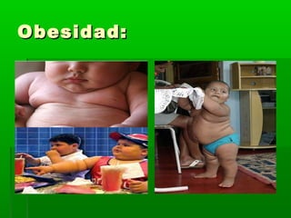 Obesidad:Obesidad:
 
