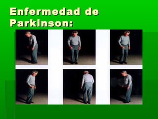 Enfermedad deEnfermedad de
Parkinson:Parkinson:
 