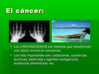 El cáncer:El cáncer:
 Los CARCINÓGENOS son factores que transformanLos CARCINÓGENOS son factores que transforman
una célula normal en cancerosa.una célula normal en cancerosa.
 Los más importantes son: radiaciones, sustanciasLos más importantes son: radiaciones, sustancias
químicas, partículas y agentes mutagénicos,químicas, partículas y agentes mutagénicos,
sustancias alimenticias, etc.sustancias alimenticias, etc.
 