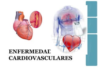 ENFERMEDADES
CARDIOVASCULARES
 