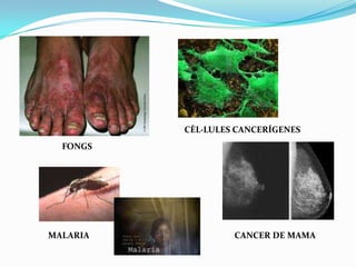 CÈL·LULES CANCERÍGENESFONGSCANCER DE MAMAMALARIA