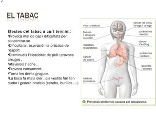 Efectes del tabac a curt termini:
•Provoca mal de cap i dificultats per
concentrar-se
•Dificulta la respiració i la pràctica de
l'esport
•Disminueix l'elasticitat de pell i provoca
arruges .
•Afavoreix l' acne .
•Provoca cansament .
•Torna les dents grogues.
•La boca fa mala olor , els vestits fan fan
pudor i genera bruticia (cendra, burilles ....)
 