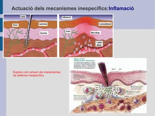 Actuació dels mecanismes inespecífics:Inflamació

Explica com actuen els mecanismes
de defensa inespecífics

 