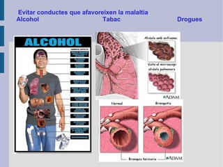 Evitar conductes que afavoreixen la malaltia
Alcohol
Tabac

Drogues

 