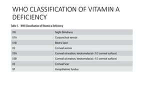 WHO CLASSIFICATION OF VITAMIN A
DEFICIENCY
 