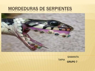 GRUPO 7
MORDEDURAS DE SERPIENTES
SAMANTA
TAPIA
 