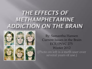 By: Samantha Hansen Current Issues in the Brain ECE/PSYC 275  Winter 2012 (Photo on left is a meth user over several years of use.) 