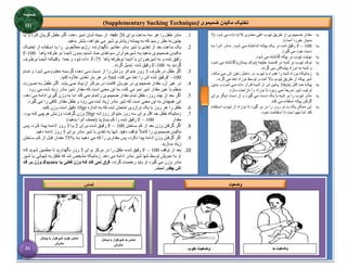  The supplementation is given via an NGT n° 8 (5 is too small) 
‫معدوی‬ ‫انفی‬ ‫تیوب‬ ‫طریق‬ ‫از‬ ‫ضمیموی‬ ‫مقدار‬
n°8
( ‫شود‬ ‫می‬ ‫داده‬
5
)‫است‬ ‫خورد‬ ‫بسیار‬

F – 100
‫بيه‬ ‫آنيرا‬ ‫ميادر‬ .‫شيود‬ ‫ميی‬ ‫انداختيه‬ ‫پیاليه‬ ‫یيک‬ ‫در‬ ‫شده‬ ‫رقیق‬
.‫گیرد‬ ‫می‬ ‫خود‬ ‫دست‬

.‫شود‬ ‫می‬ ‫گذاشته‬ ‫پیاله‬ ‫در‬ ‫تیوب‬ ‫نهایت‬

‫(نوک‬ ‫حلیمه‬ ‫قسمت‬ ‫در‬ ‫ثدیه‬ ‫بر‬ ‫تیوب‬ ‫نوک‬
‫شيود‬ ‫می‬ ‫گذاشته‬ )‫پستان‬
.‫گردد‬ ‫می‬ ‫پیشکش‬ ‫نوزاد‬ ‫به‬ ‫ثدیه‬ ‫و‬

،‫مکيد‬ ‫ميی‬ ‫اش‬ ‫دهين‬ ‫داخيل‬ ‫در‬ ‫تیوب‬ ‫با‬ ‫همراه‬ ‫را‬ ‫ثدیه‬ ‫نوزاد‬ ‫زمانیکه‬
.‫گردد‬ ‫می‬ ‫اخذ‬ ‫نوزاد‬ ‫توسط‬ ‫و‬ ‫آمده‬ ‫باال‬ ‫تیوب‬ ‫طریق‬ ‫از‬ ‫پیاله‬ ‫شیر‬

‫يل‬‫ي‬‫اق‬ ‫يد‬‫ي‬‫ح‬ ‫يه‬‫ي‬‫پیال‬
10cm
‫يدین‬‫ي‬‫ب‬ ‫و‬ ‫يود‬‫ي‬‫ش‬ ‫يی‬‫ي‬‫م‬ ‫داده‬ ‫يرار‬‫ي‬‫ق‬ ‫يه‬‫ي‬‫ثدی‬ ‫از‬ ‫ير‬‫ي‬‫ت‬ ‫يائین‬‫ي‬‫پ‬
‫ت‬ ‫ریزد‬ ‫نمی‬ ً‫ا‬‫سریع‬ ‫شیر‬ ‫ترتیب‬
.‫سازد‬ ‫ناراحت‬ ‫را‬ ‫نوزاد‬ ‫ا‬

‫برای‬ ‫دیگر‬ ‫دست‬ ‫از‬ ‫و‬ ‫گیرد‬ ‫می‬ ‫دست‬ ‫یک‬ ‫با‬ ‫ثدیه‬ ‫بر‬ ‫را‬ ‫تیوب‬ ‫مادر‬
.‫کند‬ ‫می‬ ‫استفاده‬ ‫پیاله‬ ‫گرفتن‬

‫اسيتفاده‬ ‫تیيوب‬ ‫از‬ ‫نيوزاد‬ ‫تا‬ ‫گیرد‬ ‫بر‬ ‫در‬ ‫را‬ ‫روز‬ ‫دو‬ ‫یا‬ ‫یک‬ ‫ممکن‬ ‫این‬
.‫نمود‬ ‫استقامت‬ ‫تا‬ ‫است‬ ‫مهم‬ ‫اما‬ ‫کند‬
‫ضمیموی‬ ‫مکیدن‬ ‫تخنیک‬
(Supplementary Sucking Technique)
1
.
‫برای‬ ‫ساعت‬ ‫سه‬ ‫هر‬ ‫را‬ ‫طفل‬ ‫مادر‬
20
‫یيا‬ ‫و‬ ‫کيرد‬ ‫گریيان‬ ‫طفيل‬ ‫اگير‬ ،‫دهيد‬ ‫شيیر‬ ‫شيان‬ ‫سینه‬ ‫از‬ ‫دقیقه‬
.‫بدهید‬ ‫بشتر‬ ،‫خواهد‬ ‫می‬ ‫شیر‬ ‫زیادتری‬ ‫پیمانه‬ ‫به‬ ‫که‬ ‫رسید‬ ‫نظر‬ ‫به‬ ‫چنین‬
2
.
‫تخنیيک‬ ‫از‬ ‫اسيتفاده‬ ‫بيا‬ ‫را‬ ‫معالجوی‬ ‫رژیم‬ ‫نگهدارنده‬ ‫مقادیر‬ ‫مادر‬ ‫شیر‬ ‫با‬ ‫تغذی‬ ‫از‬ ‫بعد‬ ‫ساعت‬ ‫یک‬
‫پاهيا‬ ‫طرفيه‬ ‫دو‬ ‫اذیميا‬ ‫بيدون‬ ‫شيدید‬ ‫حياد‬ ‫سيوتغذی‬ ‫شيیرخواران‬ ‫بيه‬.‫بدهید‬ ‫ضيمیموی‬ ‫مکیيدن‬
F-100
‫پاها‬ ‫دوطرفه‬ ‫اذیما‬ ‫با‬ ‫شیرخوران‬ ‫به‬ ‫و‬ ‫شده‬ ‫رقیق‬
F-75
‫برطيرف‬ ‫اذیميا‬ ‫وقتیکيه‬ ‫بعيدا‬ ‫و‬ ‫شود‬ ‫داده‬
‫به‬ ‫گردید‬
F-100
.‫گردد‬ ‫تبدیل‬ ‫شده‬ ‫رقیق‬
3
.
‫ظيرف‬ ‫در‬ ‫طفل‬ ‫اگر‬
3
‫تميام‬ ‫و‬ ‫شيود‬ ‫ميی‬ ‫معليوم‬ ‫گرسينه‬ ،‫دهيد‬ ‫ميی‬ ‫دسيت‬ ‫از‬ ‫را‬ ‫وزنيش‬ ‫متيواتر‬ ‫روز‬
100
F –
،‫کند‬ ‫می‬ ‫اخذ‬ ‫را‬ ‫اش‬ ‫شده‬ ‫رقیق‬
5ml
.‫کنید‬ ‫عالوه‬ ‫تغذی‬ ‫بار‬ ‫هر‬ ‫در‬
4
.
‫جر‬ ‫در‬ ‫ضمیموی‬ ‫مقدار‬ ،‫آن‬ ‫غیر‬ ‫در‬
‫صيورت‬ ‫بيه‬ ‫طفيل‬ ‫اگير‬ .‫یابيد‬ ‫نميی‬ ‫ازدیياد‬ ‫مرکيز‬ ‫در‬ ‫اقامت‬ ‫یان‬
.‫رود‬ ‫می‬ ‫شده‬ ‫زیاد‬ ‫مادر‬ ‫شیر‬ ‫مقدار‬ ‫که‬ ‫است‬ ‫معنی‬ ‫این‬ ‫به‬ ،‫کند‬ ‫می‬ ‫نمو‬ ‫شیر‬ ‫مقدار‬ ‫عین‬ ‫با‬ ‫منظم‬
5
.
،‫دهد‬ ‫می‬ ‫ادامه‬ ‫گیری‬ ‫وزن‬ ‫به‬ ‫اما‬ ‫کند‬ ‫نمی‬ ‫راتمام‬ ‫ضمیموی‬ ‫مقدار‬ ‫تمام‬ ‫طفل‬ ،‫روز‬ ‫چند‬ ‫از‬ ‫بعد‬ ‫اگر‬
‫شیر‬ ‫که‬ ‫است‬ ‫معنی‬ ‫این‬ ‫به‬ ‫همچنان‬ ‫این‬
.‫گیرد‬ ‫می‬ ‫را‬ ‫کافی‬ ‫مقدار‬ ‫طفل‬ ‫و‬ ‫رود‬ ‫می‬ ‫شده‬ ‫زیاد‬ ‫مادر‬
6
.
‫اندازه‬ ‫به‬ ‫که‬ ‫شده‬ ‫امتحان‬ ‫ترازوی‬ ‫یک‬ ‫با‬ ‫روز‬ ‫هر‬ ‫را‬ ‫طفل‬
10gr
.‫کنید‬ ‫وزن‬ ‫است‬ ‫دقیق‬
7
.
‫روزانيه‬ ‫متيواتر‬ ‫روز‬ ‫سه‬ ‫برای‬ ‫اقل‬ ‫حد‬ ‫طفل‬ ‫زمانیکه‬
20gr
:‫بيود‬ ‫کيه‬ ‫هرچيی‬ ‫وزنيش‬ ،‫گرفيت‬ ‫وزن‬
‫مقدار‬
F – 100
‫(ن‬ ‫بسازید‬ ‫کم‬ ‫را‬ ‫شده‬ ‫رقیق‬
)‫بدهید‬ ‫آنرا‬ ‫صف‬
8
.
‫سياختن‬ ‫کم‬ ‫از‬ ‫بعد‬ ‫وزن‬ ‫گرفتن‬ ‫اگر‬
F – 100
‫بيرای‬ ‫شيده‬ ‫رقیيق‬
2
‫یيا‬
3
‫پيس‬ ،‫کيرد‬ ‫پیيدا‬ ‫اداميه‬ ‫روز‬
‫برای‬ ‫مادر‬ ‫شیر‬ ‫با‬ ‫تغذی‬ ‫به‬ ‫تنها‬ .‫دهید‬ ‫توقف‬ ً‫ال‬‫کام‬ ‫را‬ ‫ضمیموی‬ ‫مکیدن‬
5
.‫دهید‬ ‫ادامه‬ ‫روز‬
9
.
% ‫بيه‬ ‫دهیيد‬ ‫می‬ ‫که‬ ‫را‬ ‫مقداری‬ ‫پس‬ ،‫نکرد‬ ‫پیدا‬ ‫ادامه‬ ‫وزن‬ ‫گرفتن‬ ‫اگر‬
75
‫کيم‬ ‫از‬ ‫قبيل‬ ‫مقيدار‬
‫سياختن‬
.‫بسازید‬ ‫زیاد‬
10
.
‫توقف‬ ‫از‬ ‫بعد‬
F – 100
‫برای‬ ‫مرکز‬ ‫در‬ ‫را‬ ‫طفل‬ ،‫شده‬ ‫رقیق‬
5
‫کيه‬ ‫شيوید‬ ‫مطميین‬ ‫تا‬ ‫نگهدارید‬ ‫روز‬
‫شيیر‬ ‫بيا‬ ‫تنهيائی‬ ‫به‬ ‫طفل‬ ‫که‬ ‫شد‬ ‫مشخص‬ ‫زمانیکه‬ .‫دهد‬ ‫می‬ ‫ادامه‬ ‫مادر‬ ‫شیر‬ ‫تنها‬ ‫توسط‬ ‫نمویش‬ ‫به‬ ‫او‬
،‫گردد‬ ‫رخصت‬ ‫باید‬ ‫او‬ ‫گیرد‬ ‫می‬ ‫وزن‬ ‫مادر‬
‫یلا‬ ‫فعللی‬ ‫وزن‬ ‫کله‬ ‫کند‬ ‫نمی‬ ‫فرق‬
Zscore
‫قلد‬ ‫بلر‬ ‫وزن‬
‫است‬ ‫چقدر‬ ‫اش‬
.
‫خوب‬ ‫تماس‬
‫پستان‬ ‫با‬ ‫شيرخوار‬
‫مادرش‬
‫پستان‬ ‫با‬ ‫شيرخوار‬ ‫بد‬ ‫تماس‬
‫مادرش‬
‫خوب‬ ‫وضعیت‬ ‫بد‬ ‫وضعیت‬
‫تماس‬ ‫عيت‬ ‫و‬
21
‫ميمه‬
(
5
)
 