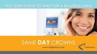 Same Day Crowns