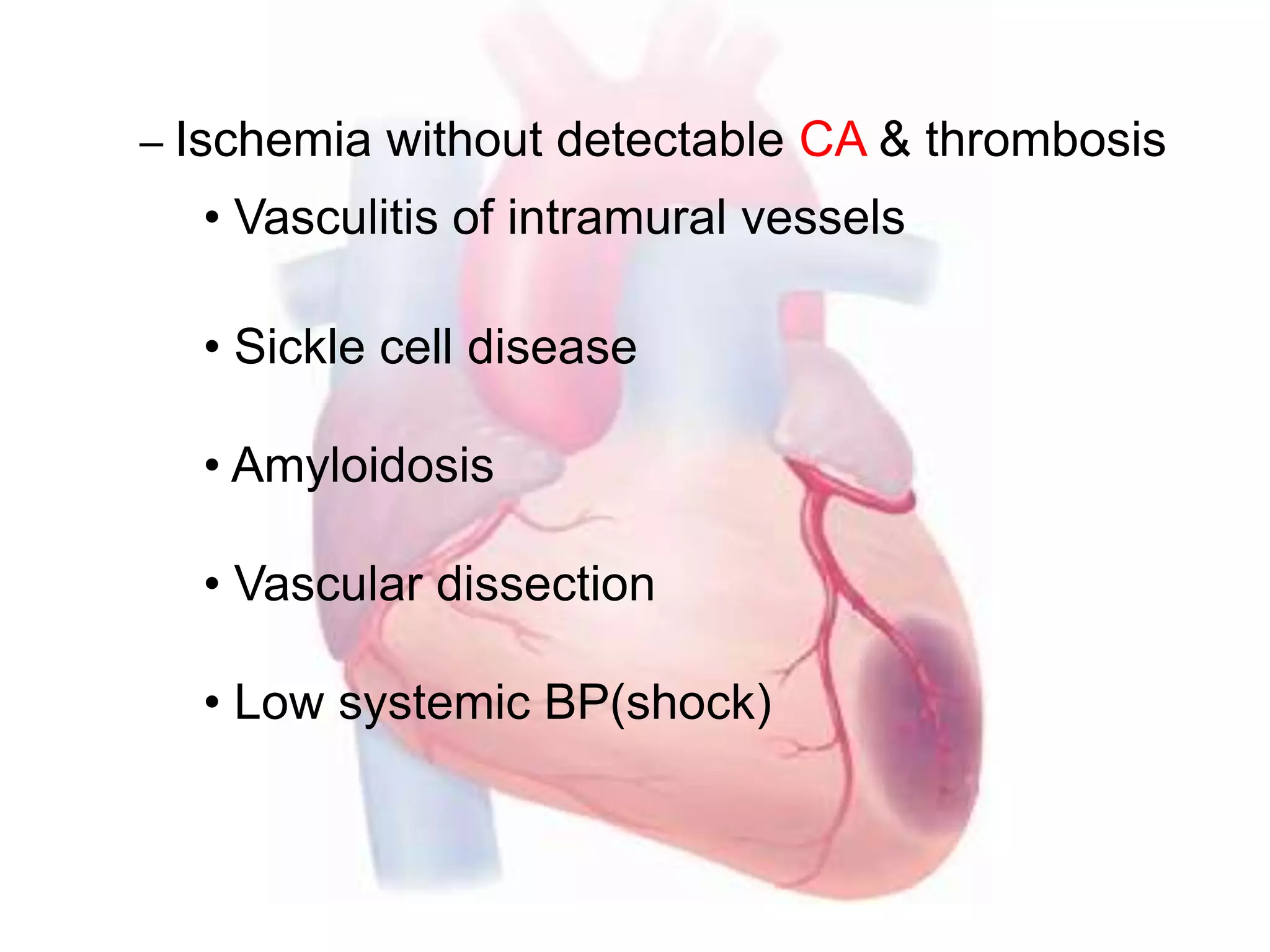 – Ischemia without detectable CA & thrombosis
• Vasculitis of intramural vessels
• Sickle cell disease
• Amyloidosis
• Vascular dissection
• Low systemic BP(shock)
 