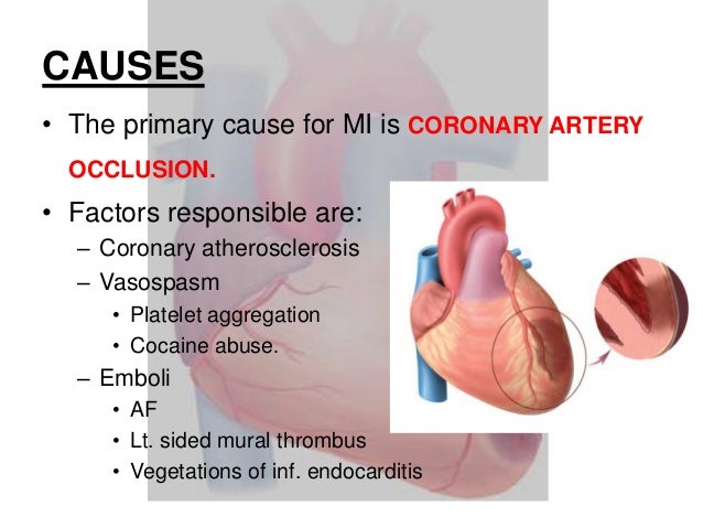 the different causes of myocardial infarction Causes of ischemia: • different parenchymal cells have different • angina pectoris, myocardial infarction, sudden. the different causes of myocardial infarction Causes of ischemia: • different parenchymal cells have different • angina pectoris, myocardial infarction, sudden.