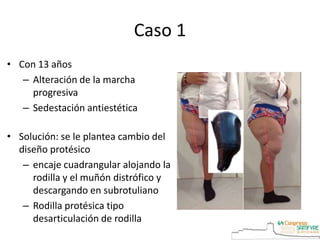 Caso 1
• Con 13 años
– Alteración de la marcha
progresiva
– Sedestación antiestética
• Solución: se le plantea cambio del
diseño protésico
– encaje cuadrangular alojando la
rodilla y el muñón distrófico y
descargando en subrotuliano
– Rodilla protésica tipo
desarticulación de rodilla
 