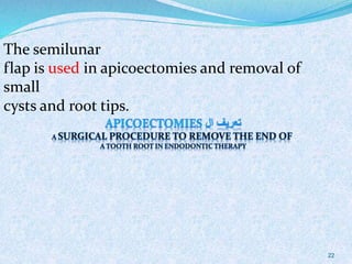 The semilunar
flap is used in apicoectomies and removal of
small
cysts and root tips.
22
 