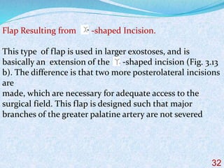 Flap Resulting from -shaped Incision.
This type of flap is used in larger exostoses, and is
basically an extension of the -shaped incision (Fig. 3.13
b). The difference is that two more posterolateral incisions
are
made, which are necessary for adequate access to the
surgical field. This flap is designed such that major
branches of the greater palatine artery are not severed
32
 