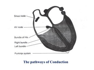 Samir rafla ecg arrhythmia for medical students- 70 slides | PDF