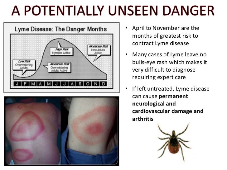 Sami Yasin MD Lyme Disease Primer