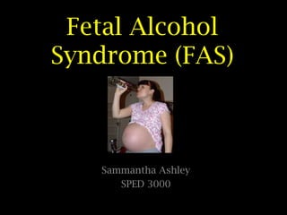 Fetal Alcohol
Syndrome (FAS)

Sammantha Ashley
SPED 3000

 