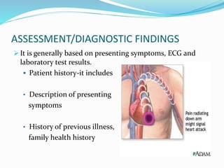 ASSESSMENT/DIAGNOSTIC FINDINGS
 It is generally based on presenting symptoms, ECG and
laboratory test results.
 Patient history-it includes
• Description of presenting
symptoms
• History of previous illness,
family health history
 