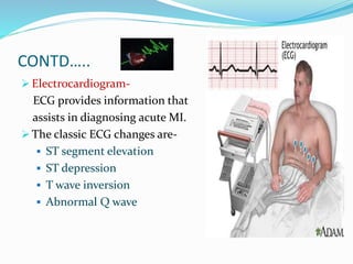 CONTD…..
 Electrocardiogram-
ECG provides information that
assists in diagnosing acute MI.
 The classic ECG changes are-
 ST segment elevation
 ST depression
 T wave inversion
 Abnormal Q wave
 