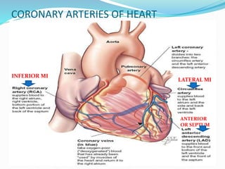 CORONARY ARTERIES OF HEART
LATERAL MI
ANTERIOR
OR SEPTUM
INFERIOR MI
 
