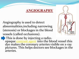 ANGIOGRAPHY
Angiography is used to detect
abnormalities,including narrowing
(stenosis) or blockages in the blood
vessels (called occlusions).
This is done by injecting a radio-
opaque contrast agent into the blood vessel this
dye makes the coronary arteries visible on x-ray
pictures. This helps doctors see blockages in the
arteries.
 