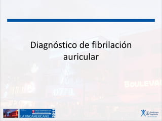 Diagnóstico de fibrilación
auricular
 