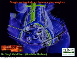 Cirugía radioguiada en tumores ginecológicos
Dr. Sergi Vidal-Sicart (Medicina Nuclear)
martes 18 de marzo de 14
 