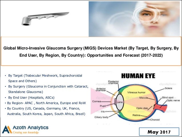 Micro invasive Surgery (MIGS) Devices market