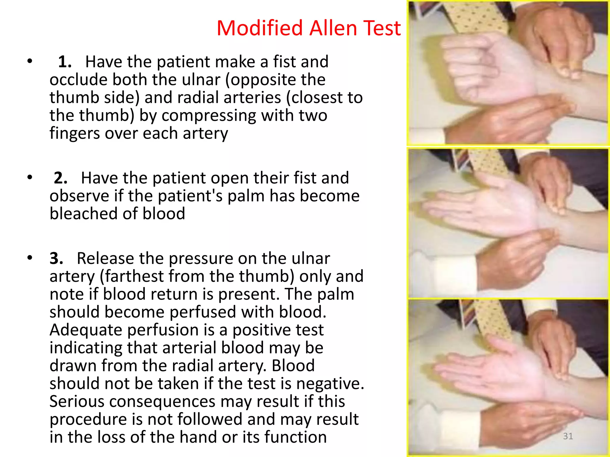 • 1. Have the patient make a fist and
occlude both the ulnar (opposite the
thumb side) and radial arteries (closest to
the thumb) by compressing with two
fingers over each artery
• 2. Have the patient open their fist and
observe if the patient's palm has become
bleached of blood
• 3. Release the pressure on the ulnar
artery (farthest from the thumb) only and
note if blood return is present. The palm
should become perfused with blood.
Adequate perfusion is a positive test
indicating that arterial blood may be
drawn from the radial artery. Blood
should not be taken if the test is negative.
Serious consequences may result if this
procedure is not followed and may result
in the loss of the hand or its function
Modified Allen Test
31
 