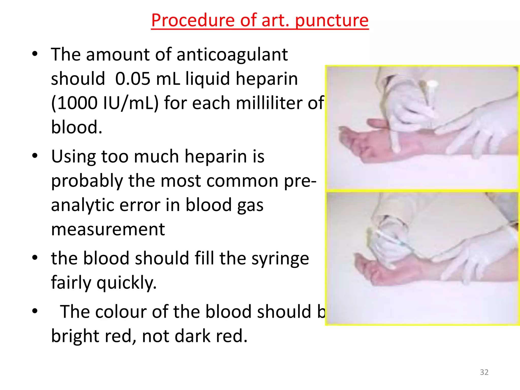 • The amount of anticoagulant
should 0.05 mL liquid heparin
(1000 IU/mL) for each milliliter of
blood.
• Using too much heparin is
probably the most common pre-
analytic error in blood gas
measurement
• the blood should fill the syringe
fairly quickly.
• The colour of the blood should be
bright red, not dark red.
Procedure of art. puncture
32
 