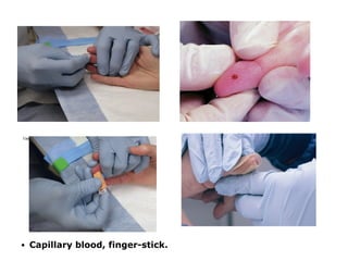 Collection & Handling of Blood Sample Hematology | PDF