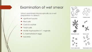 Pyuria Urine Sample Urine Sample Collection, Transport & Microbiological Processing: A Step ...