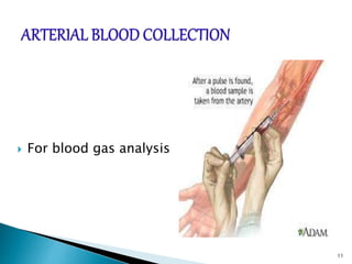  For blood gas analysis
11
 