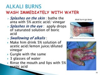  Splashes on the skin : bathe the
area with 5% acetic acid/ vinegar
 Splashes in the eye : apply drops
of saturated solution of boric
acid
 Swallowing of alkalis :
 Make him drink 5% solution of
acetic acid/lemon juice/diluted
vinegar
 Gurgle with the same
 3 glasses of water
 Rinse the mouth and lips with 5%
acetic acid
48
 