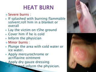  Severe burns :
 If splashed with burning flammable
solvent;roll him in a blanket or
overall
 Lay the victim on t5he ground
 Cover him if he is cold
 Inform the physician
 Minor burns :
 Plunge the area with cold water or
ice water.
 Apply mercurochrome or
acriflavine ointment
 Apply dry gauze dressing
 If infected inform the physician.
50
 