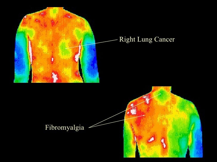 THERMOGRAM EXAMPLE IMAGES WITH EXPLANATIONS