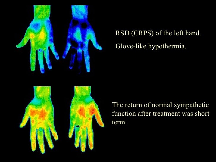 THERMOGRAM EXAMPLE IMAGES WITH EXPLANATIONS