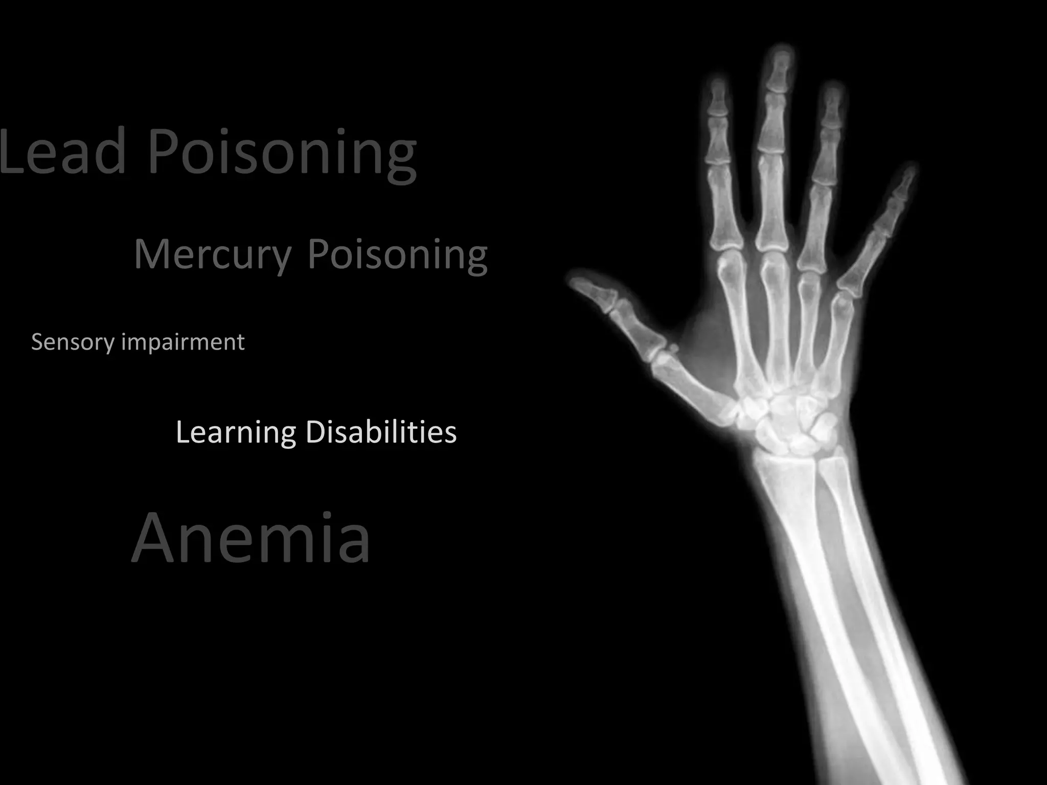 Lead Poisoning
         Mercury Poisoning
 Sensory impairment


             Learning Disabilities


         Anemia
 