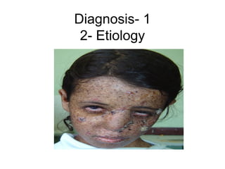 1-Diagnosis
2- Etiology
 