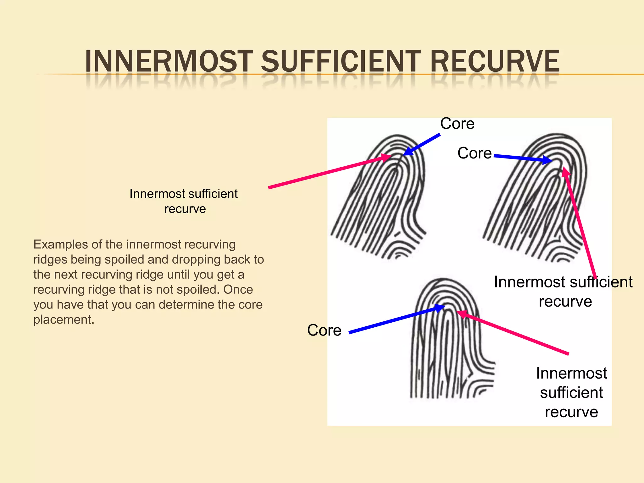 Angled Ridges Angled ridges cannot be used as type lines. The angled ridge is formed by two(2) ridges, one abutting up against the other ridge. The definition for a type line the two (2) innermost ridges that run parallel, diverge and surround or tend to surround an area of ridge detail. Since an angle is formed by formed by two separate and distinct ridges it does not meet the definition for a type line..  Type lines are these 2 innermostRidges that run parallel and diverge2 ridges meeting forming an angleCannot be used as a type line.