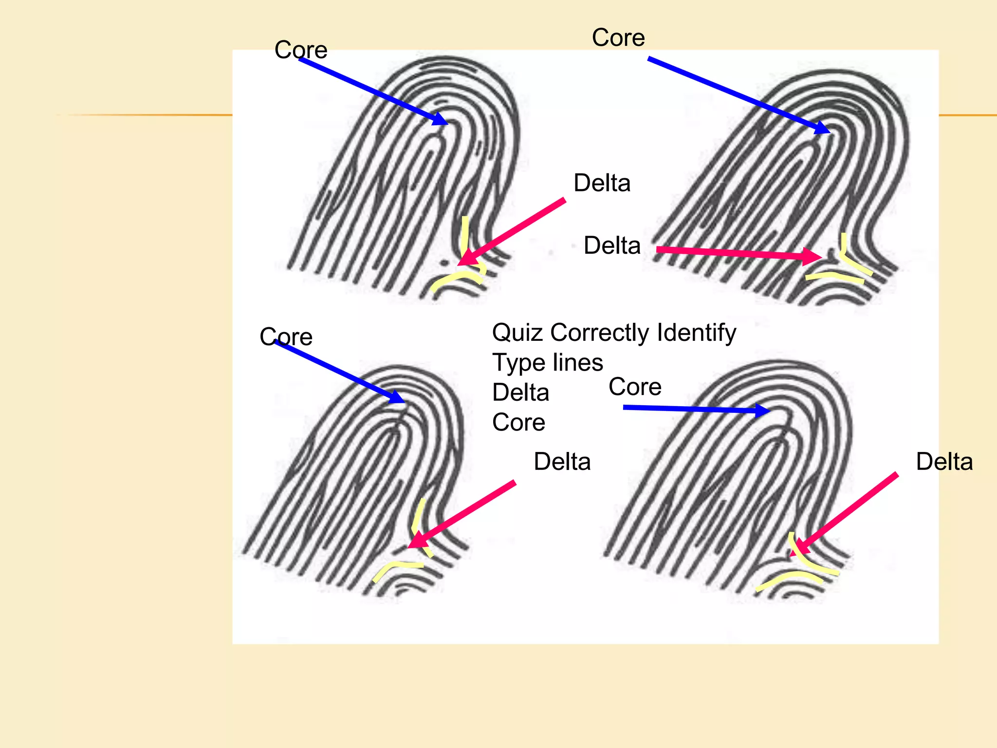 Now That You have determined Pattern AreaOnce the pattern area has been determined, you can locate theca points of that pattern:DeltaCoreRidge detailFirst we’ll look at defining and determining the delta of the fingerprint pattern. 