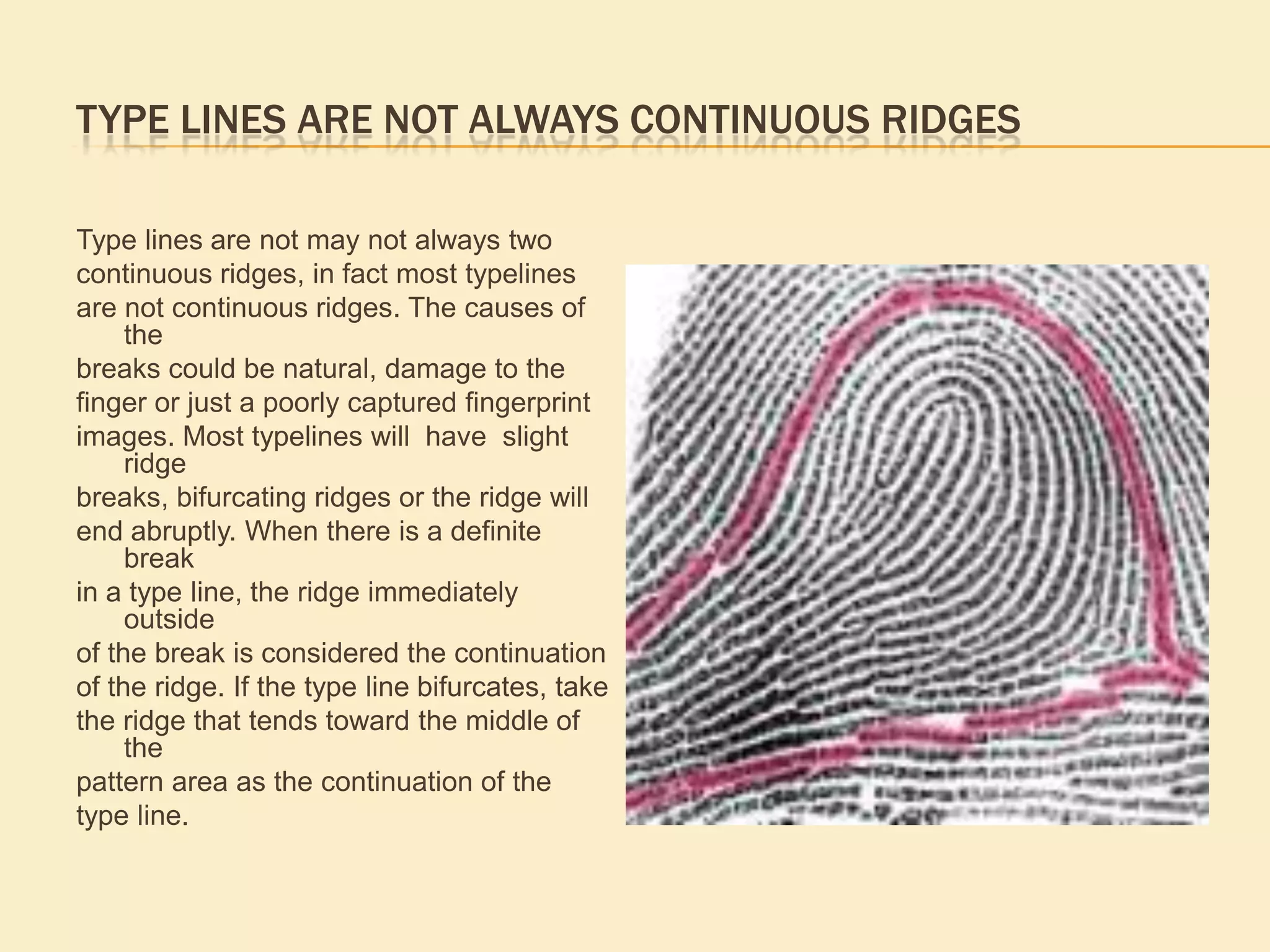 The delta first obstruction at the point of divergence of the type lines in front of or nearest the center of  the  divergence.  