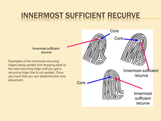 Angled Ridges Angled ridges cannot be used as type lines. The angled ridge is formed by two(2) ridges, one abutting up against the other ridge. The definition for a type line the two (2) innermost ridges that run parallel, diverge and surround or tend to surround an area of ridge detail. Since an angle is formed by formed by two separate and distinct ridges it does not meet the definition for a type line..  Type lines are these 2 innermostRidges that run parallel and diverge2 ridges meeting forming an angleCannot be used as a type line.