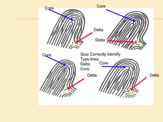 Now That You have determined Pattern AreaOnce the pattern area has been determined, you can locate theca points of that pattern:DeltaCoreRidge detailFirst we’ll look at defining and determining the delta of the fingerprint pattern. 